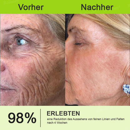 [Nur noch 30 MINUTEN] Jetzt jugendliche Haut zurückgewinnen Rolimey® Botox & Vita-A Retinol Shot Falten-Lift Straffungscreme