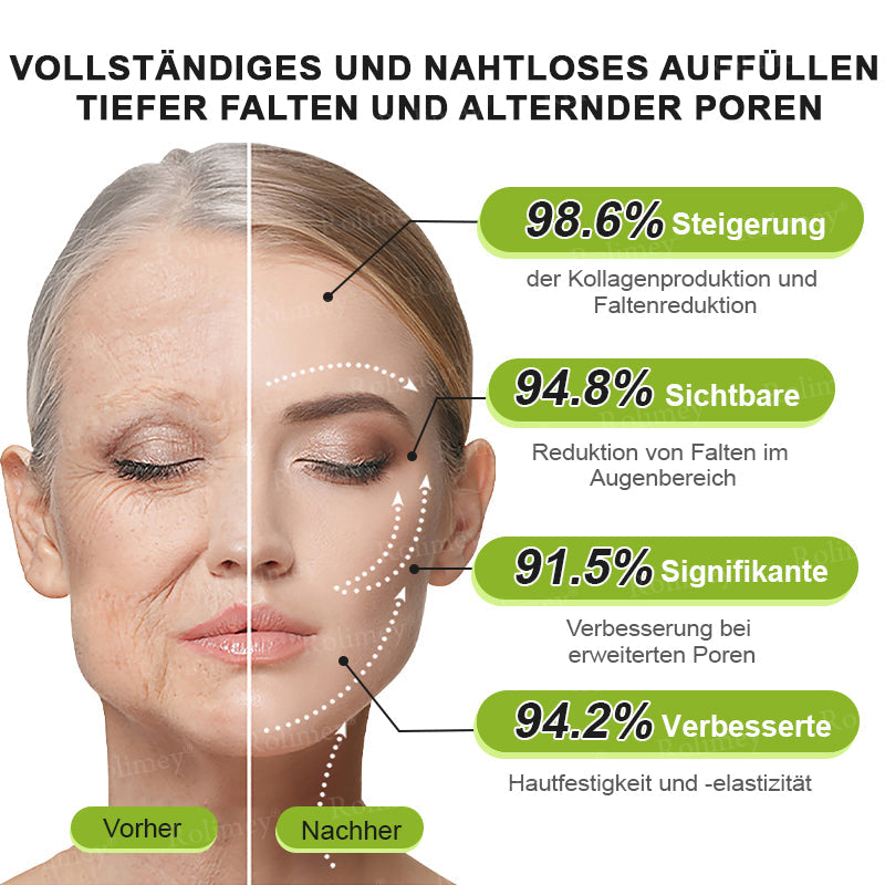 [Nur noch 30 MINUTEN] Jetzt jugendliche Haut zurückgewinnen Rolimey® Botox & Vita-A Retinol Shot Falten-Lift Straffungscreme