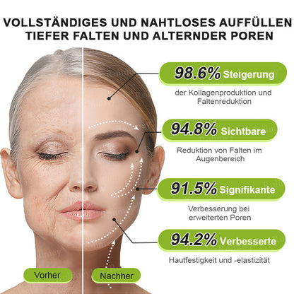 [Nur noch 30 MINUTEN] Jetzt jugendliche Haut zurückgewinnen Rolimey® Botox & Vita-A Retinol Shot Falten-Lift Straffungscreme