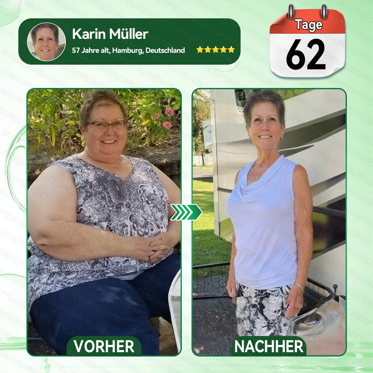✅30%✅𝑳𝒖𝒙𝒂𝒓𝒊𝒔𝒆®