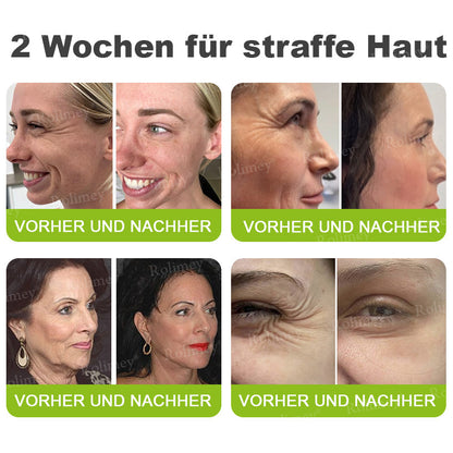 [Nur noch 30 MINUTEN] Jetzt jugendliche Haut zurückgewinnen Rolimey® Botox & Vita-A Retinol Shot Falten-Lift Straffungscreme