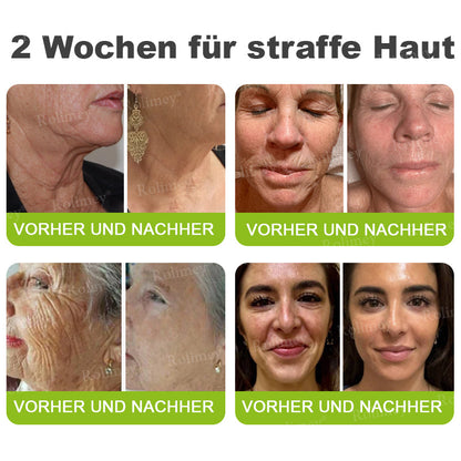 [Nur noch 30 MINUTEN] Jetzt jugendliche Haut zurückgewinnen Rolimey® Botox & Vita-A Retinol Shot Falten-Lift Straffungscreme