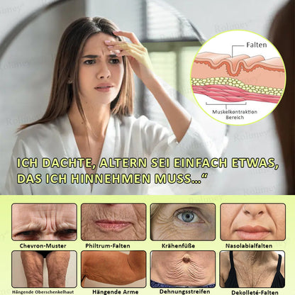 [Nur noch 30 MINUTEN] Jetzt jugendliche Haut zurückgewinnen Rolimey® Botox & Vita-A Retinol Shot Falten-Lift Straffungscreme